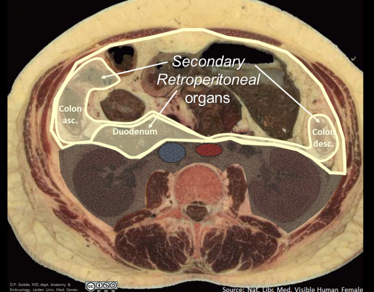 Secondary Retroperitoneal | AnatomyTOOL