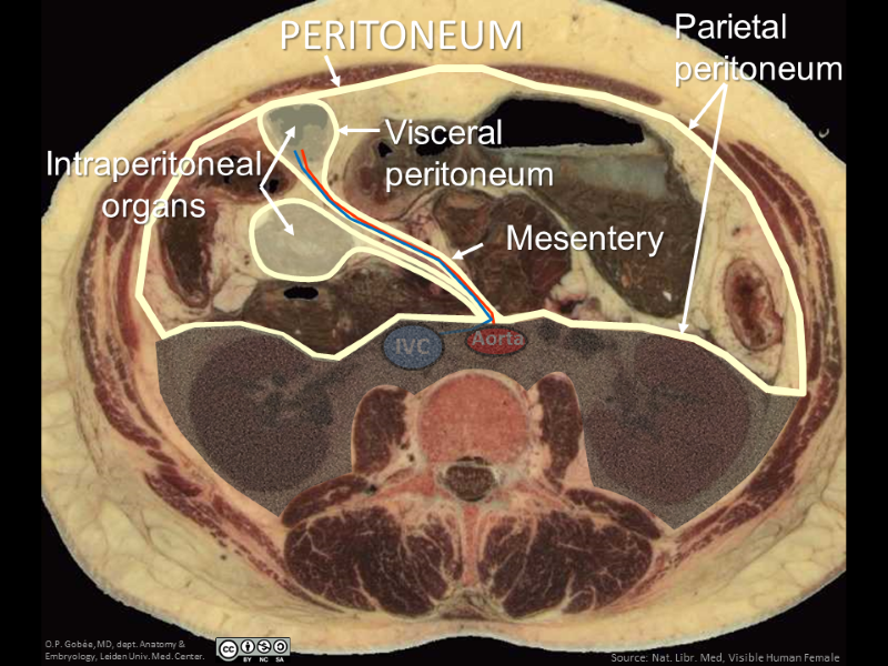 Intraperitoneal | AnatomyTOOL
